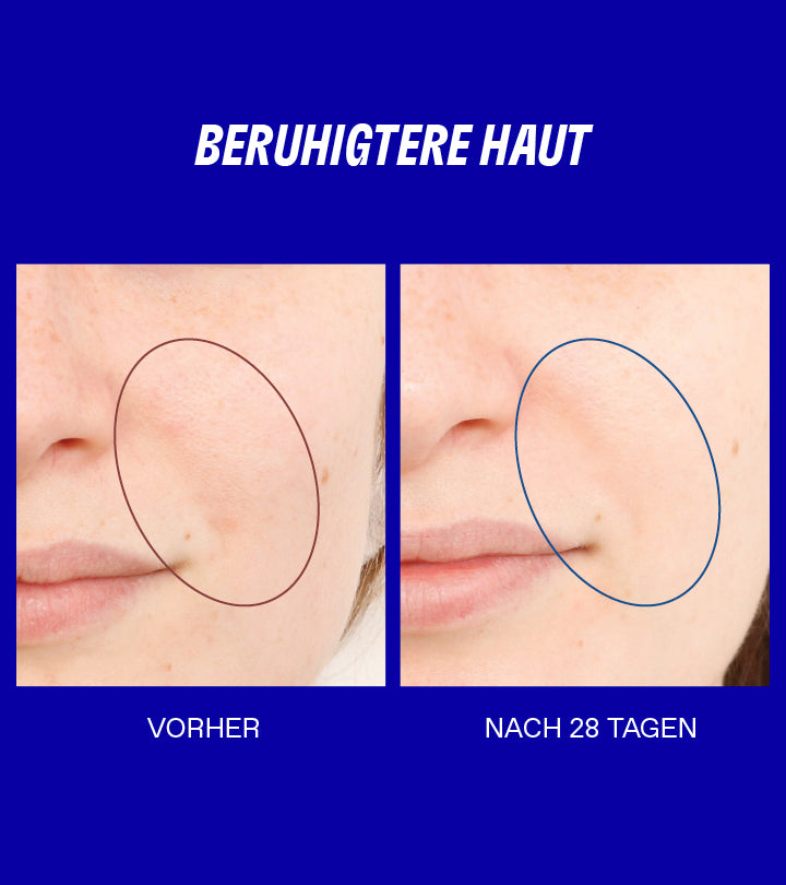 Smart Yoghurt Probiotisches Superserum - Image 6